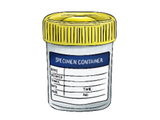 illustration of specimen container