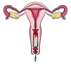 Menstruation